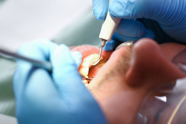 Best Emergency Dental Care for Sports Injuries in Walnutport, PA